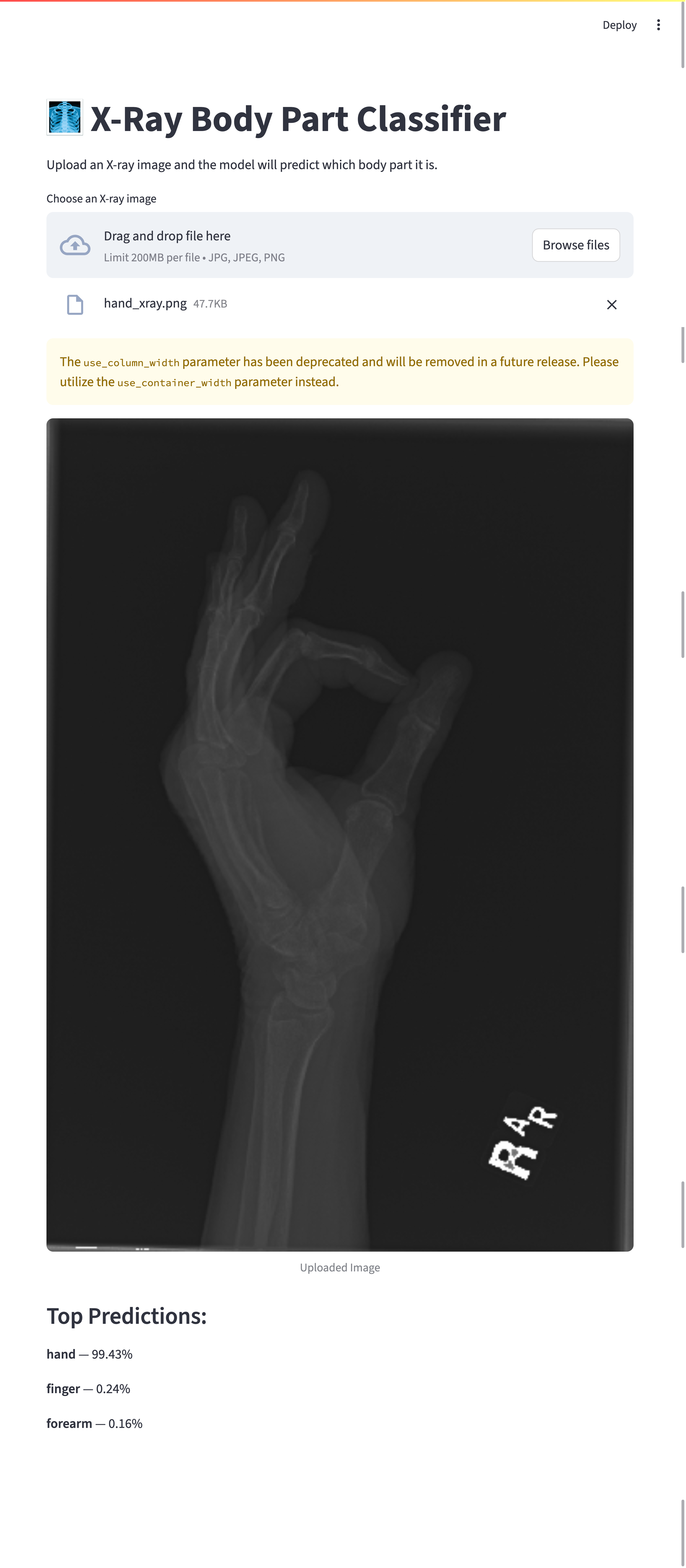 X-ray Classifier Demo